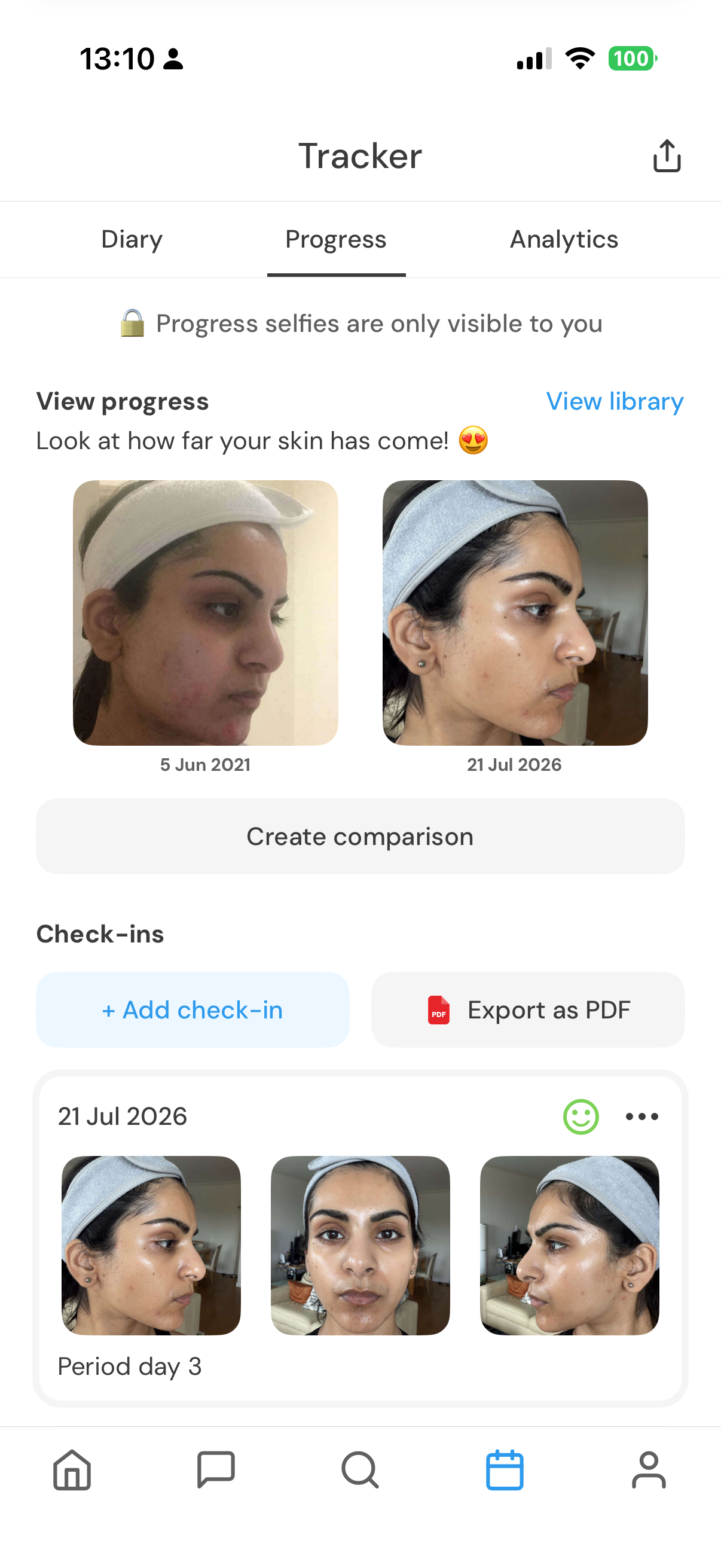 Clear progress tracker comparing private skin photos over time